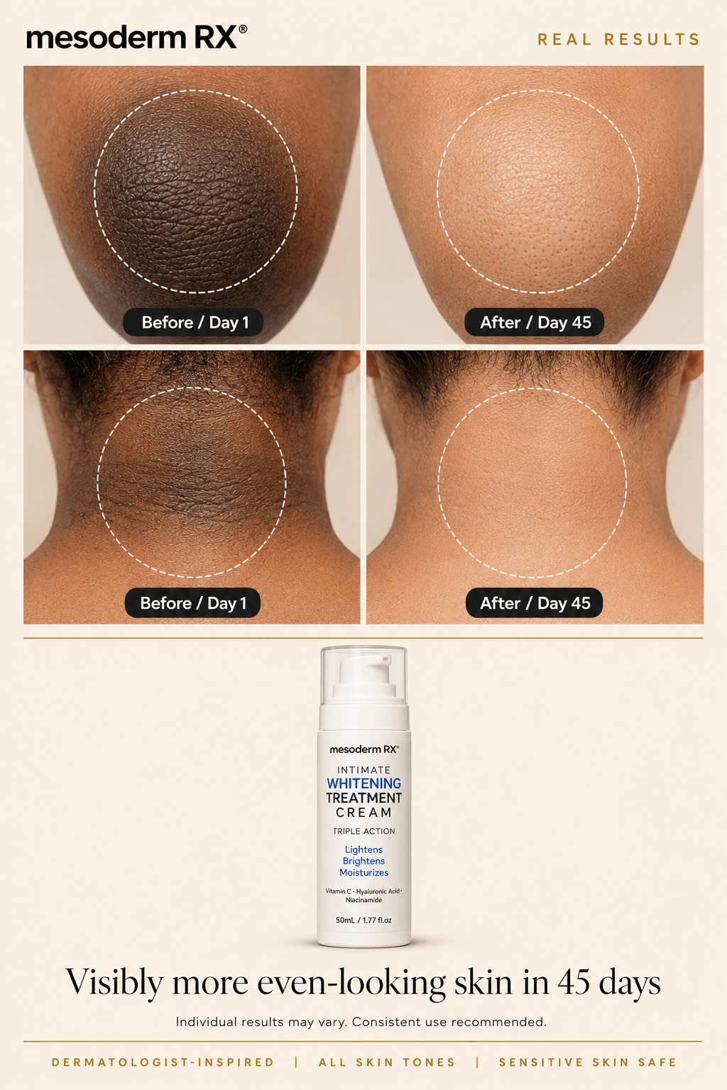Intimate Skin Lightening Cream for Under Arms, Inner Thighs & Private Area