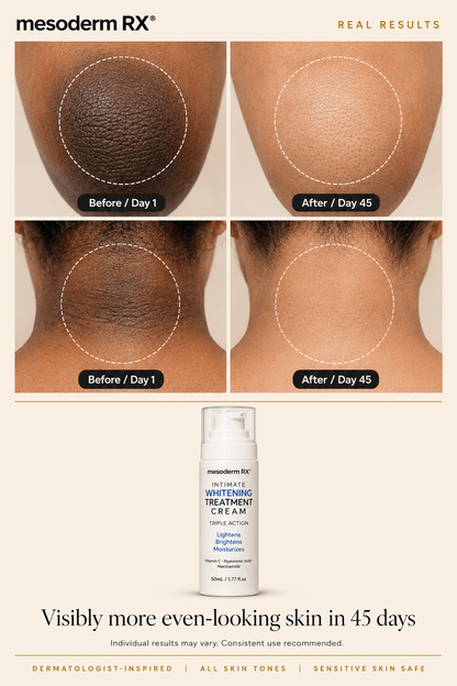 Intimate Skin Lightening Cream for Under Arms, Inner Thighs & Private Area