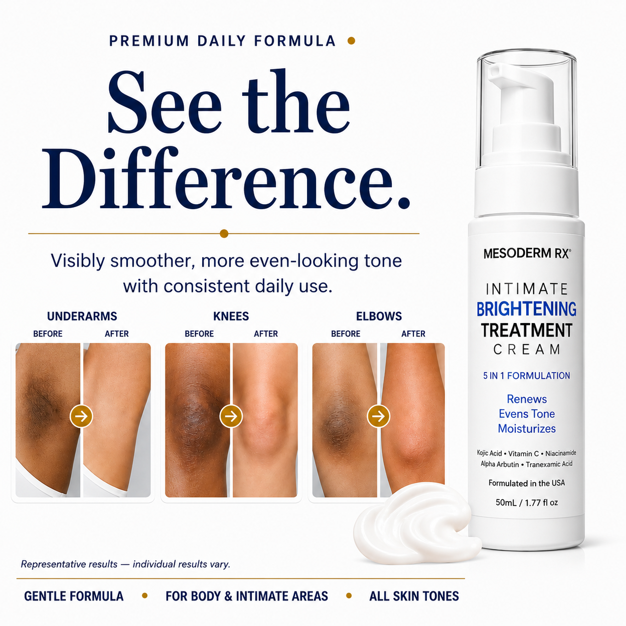 Intimate Skin Brightening Cream for Under Arms, Inner Thighs & Private Area