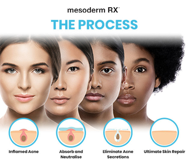 Intensive Acne Patch