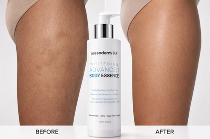 Whitening Advanced Body Essence Lotion