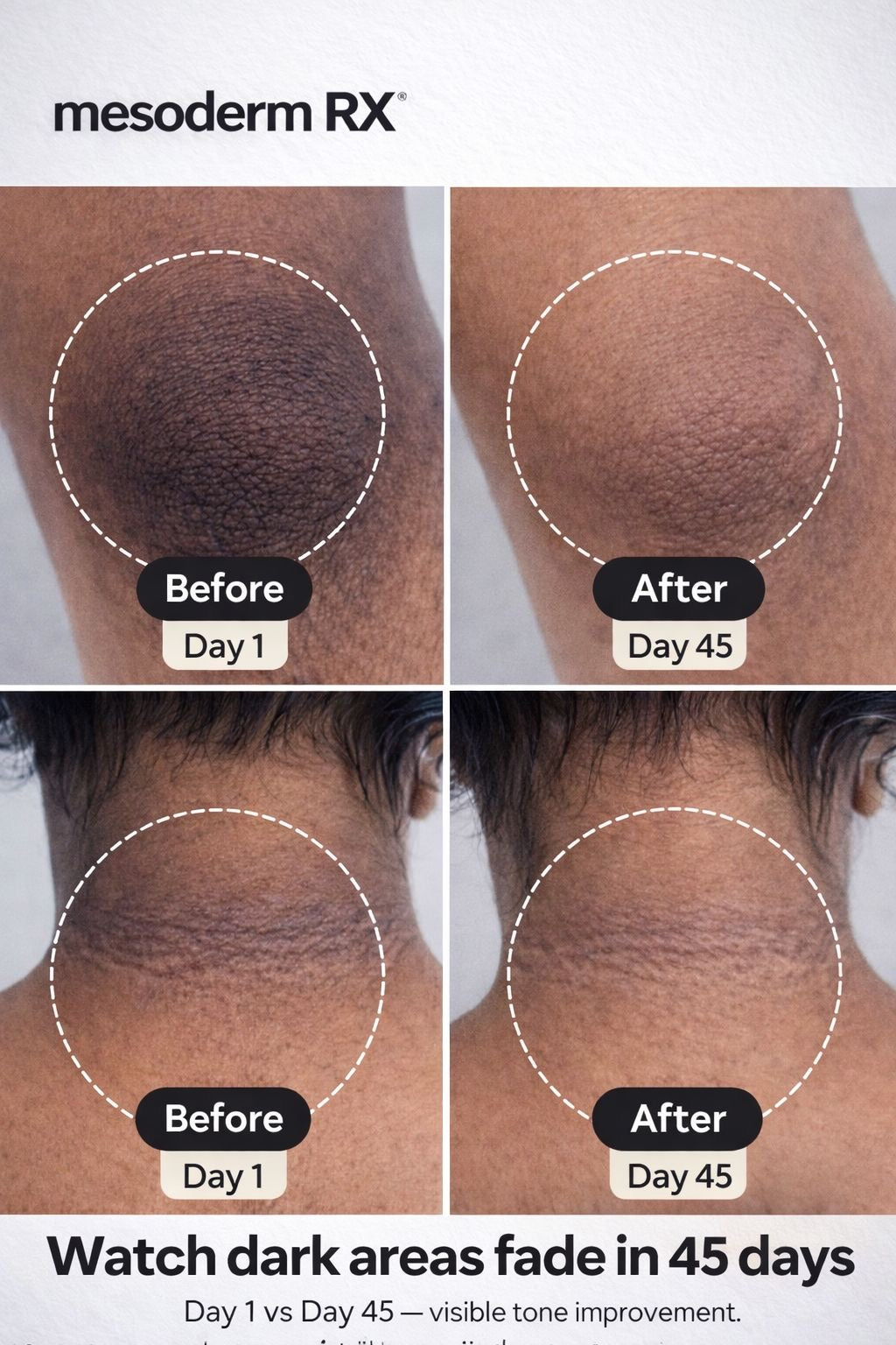 Intimate Skin Lightening Cream for Under Arms, Inner Thighs & Private Area