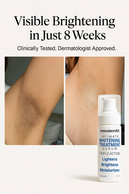 Intimate Skin Lightening Cream