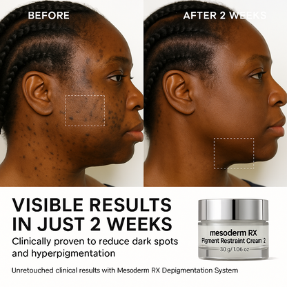 Pigment Restraint Cream 2
