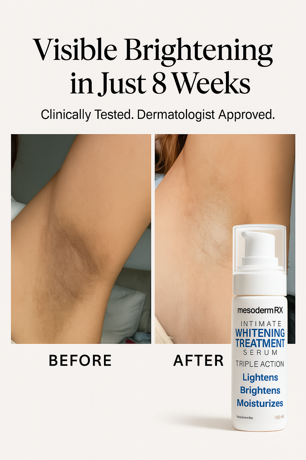 Intimate Skin Lightening Cream